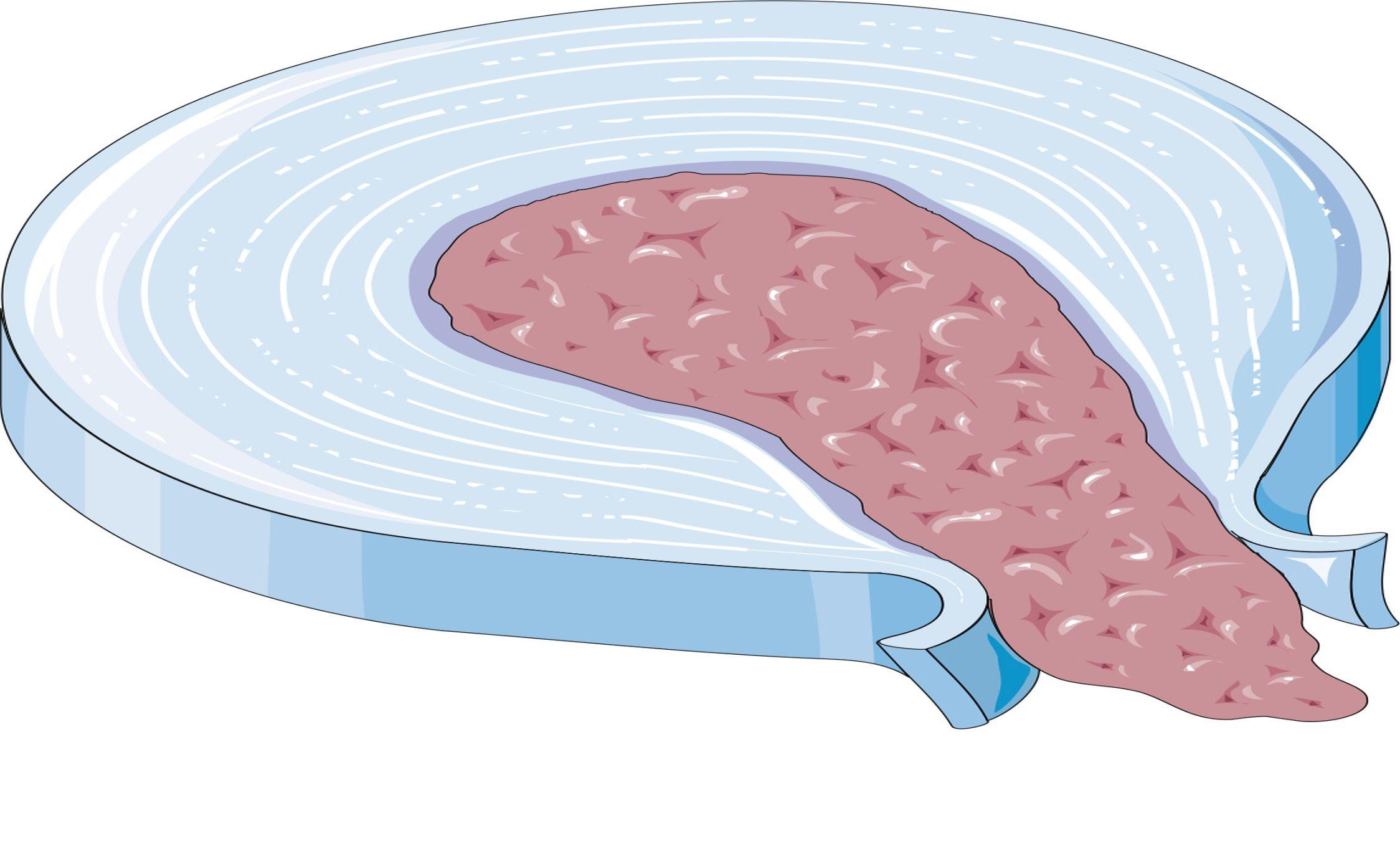 News Operationen bei LeistungssportlerInnen